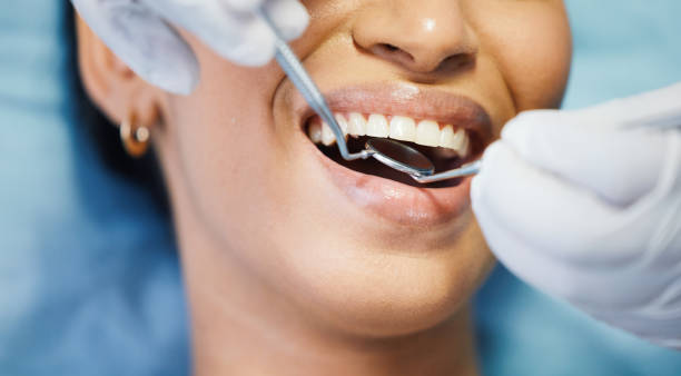 Best Emergency Dental Care for Broken or Chipped Teeth in Eloy, AZ